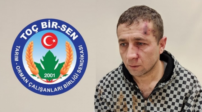 Şanlıurfa'da yaralanan veteriner hekim ile ilgili basın açıklaması;