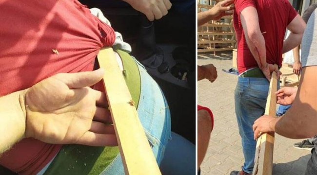 Böyle kaza Görülmedi.. Kazazede Hastaneye böyle getirildi;