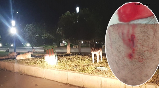 Şanlıurfa'da Hayvan Barınağı Tartışmalarının Ardından Urfa'da Sokak Köpekleri 3 Kişiye Saldırdı