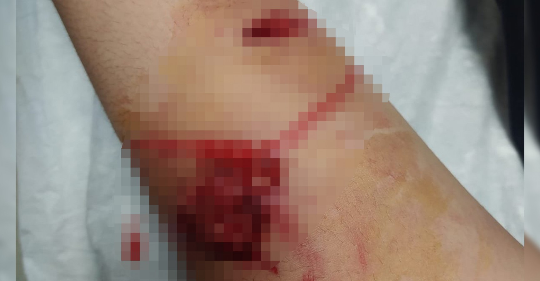 Urfa'da köpek saldırısı! Genç kadın yaralandı;