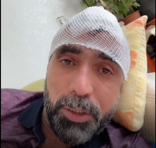 Urfalı fenomen Emin Ağa kavga anını anlattı;